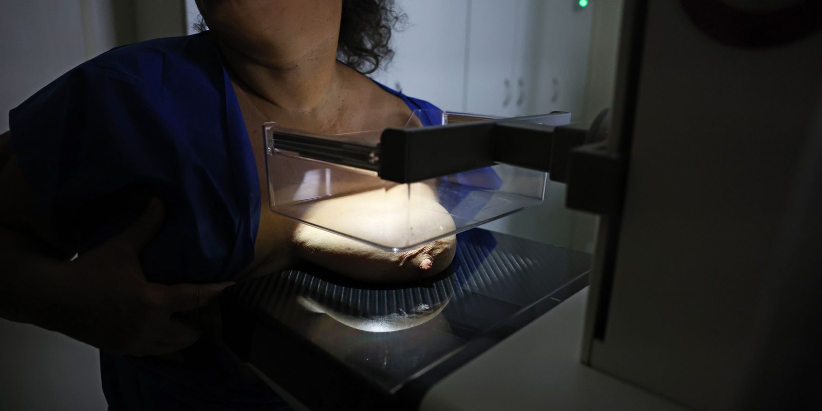 ANS propõe que planos de saúde cubram mamografia digital para todas as idades