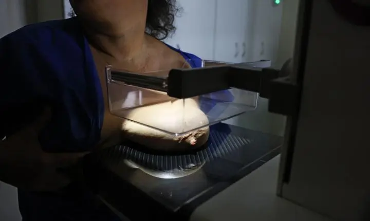ANS propõe que planos de saúde cubram mamografia digital para todas as idades