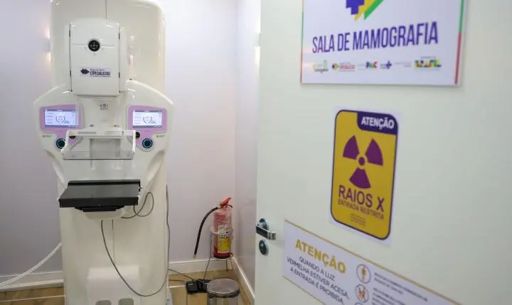 Realização de cirurgias plásticas de mama no SUS tem alta superior a 50% em dez anos com foco em reconstrução mamária